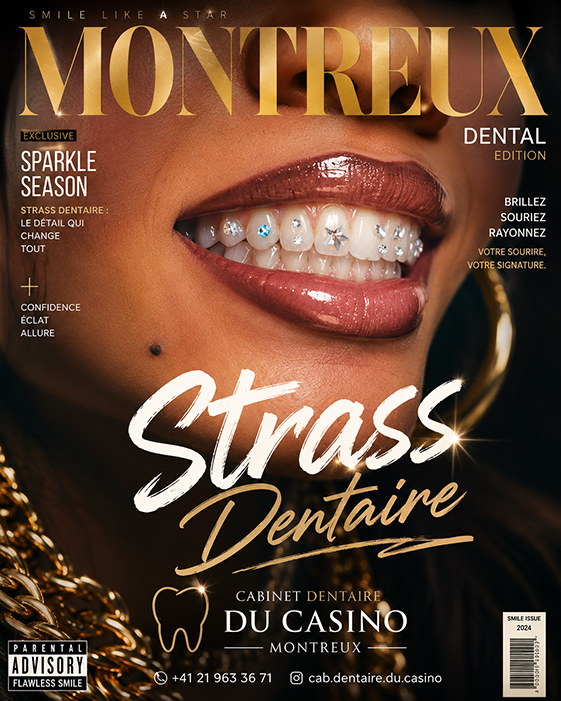 Strass dentaire posé sur une dent – Cabinet Dentaire du Casino Montreux
